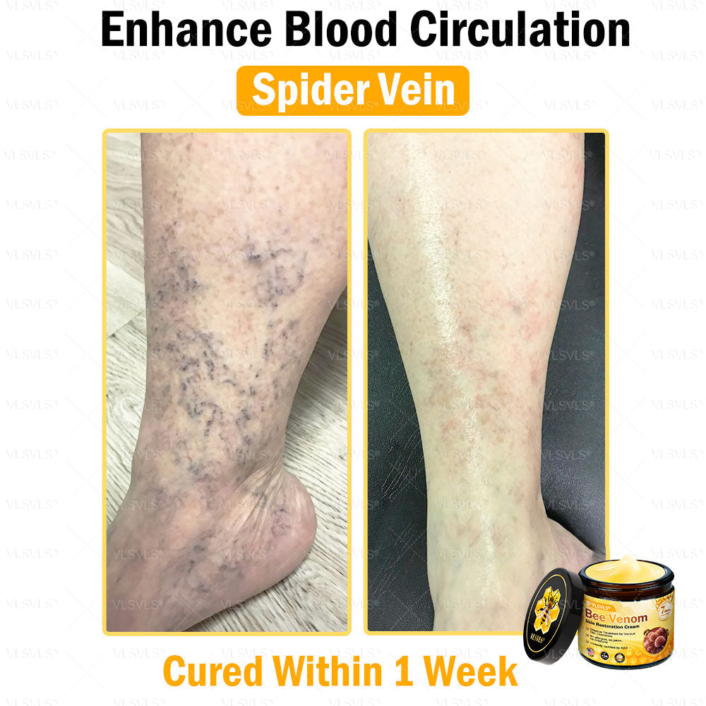 VLSVLS® Bee Venom Skin Restoration Cream (Suitable for use byindividuals of all ages & AAD recommends)✅