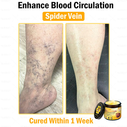 VLSVLS® Bee Venom Skin Restoration Cream (Suitable for use byindividuals of all ages & AAD recommends)✅