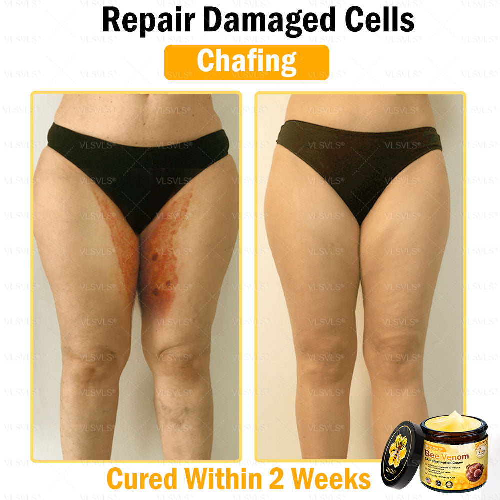 VLSVLS® Bee Venom Skin Restoration Cream (Suitable for use byindividuals of all ages & AAD recommends)✅