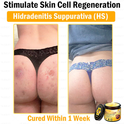 VLSVLS® Bee Venom Skin Restoration Cream (Suitable for use byindividuals of all ages & AAD recommends)✅