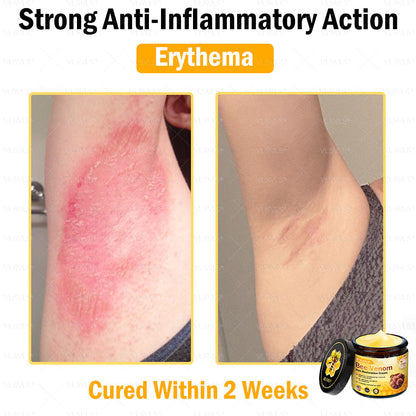 VLSVLS® Bee Venom Skin Restoration Cream (Suitable for use byindividuals of all ages & AAD recommends)✅