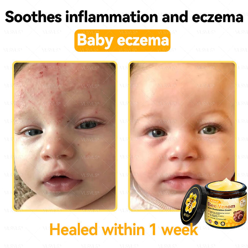 VLSVLS® Bee Venom Skin Restoration Cream (Suitable for use byindividuals of all ages & AAD recommends)✅