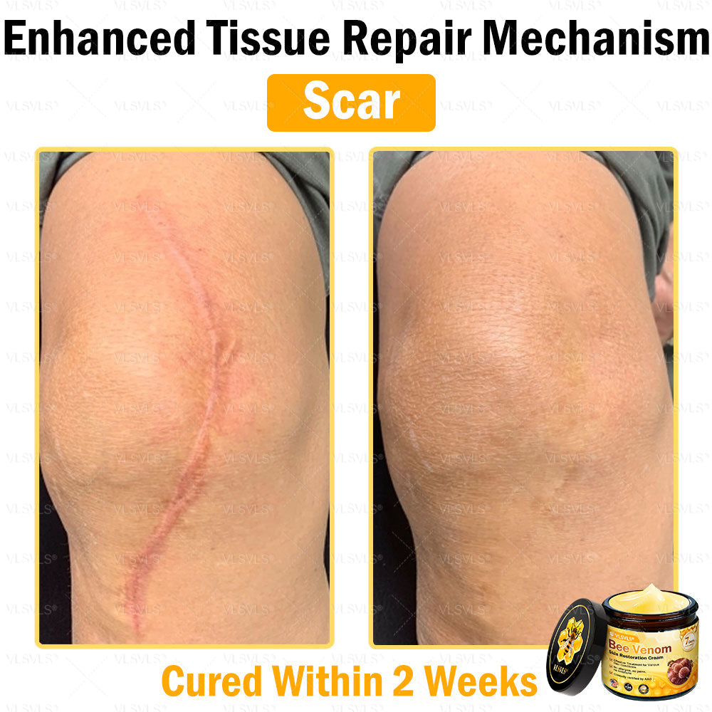 VLSVLS® Bee Venom Skin Restoration Cream (Suitable for use byindividuals of all ages & AAD recommends)✅