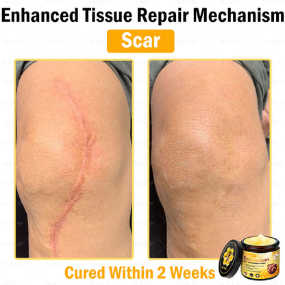 VLSVLS® Bee Venom Skin Restoration Cream (Suitable for use byindividuals of all ages & AAD recommends)✅
